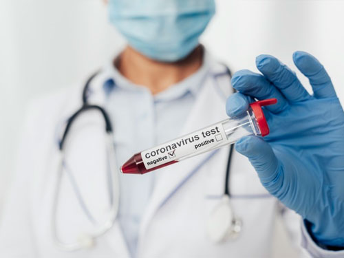 Labor- und Schnelltests