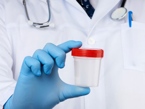 Urinbecher & Probengefäße