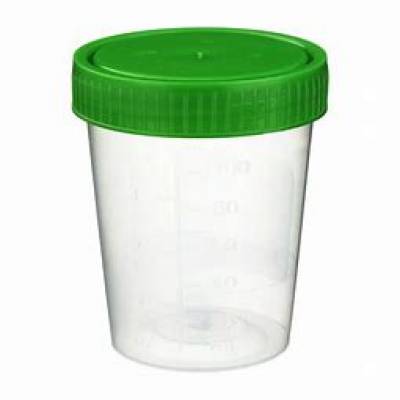 Urinbecher mit Schraubverschluß 150ml, grün, 1Stück